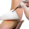 Tissue Viability - Assessment and Treatment of Wound